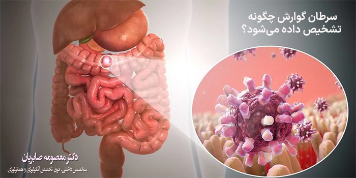 سرطان گوارش چگونه تشخیص داده میشود؟