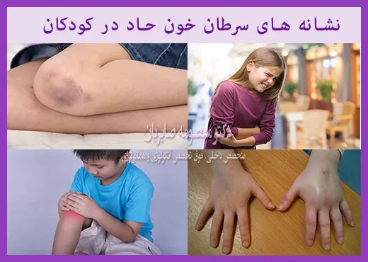 نشانه های سرطان خون حاد در کودکان