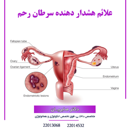 علائم هشدار دهنده سرطان رحم