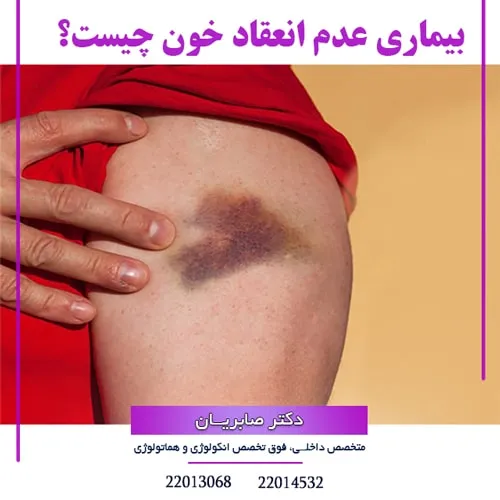 بیماری عدم انعقاد خون چیست؟