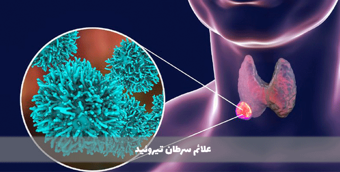 علائم سرطان تیروئید
