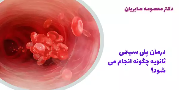 درمان پلی سیتمی ثانویه چگونه انجام می شود؟