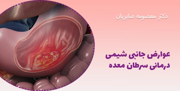 عوارض جانبی شیمی‌درمانی سرطان معده