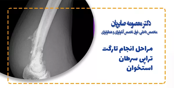 مراحل‌ انجام تارگت تراپی سرطان استخوان