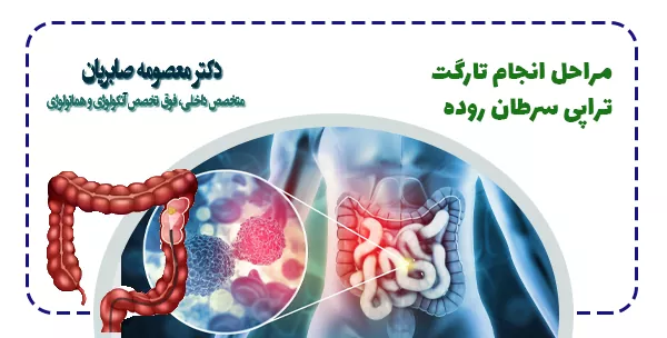 مراحل انجام تارگت تراپی سرطان روده