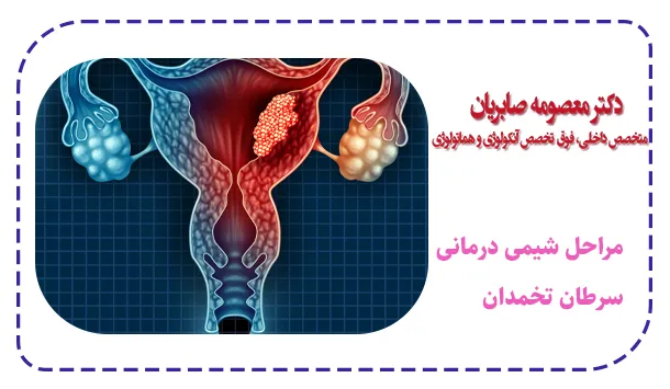 مراحل شیمی درمانی سرطان تخمدان