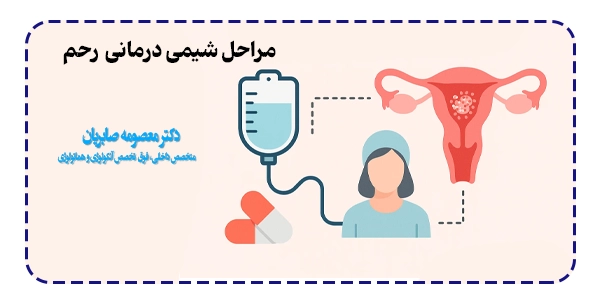 مراحل شیمی درمانی رحم